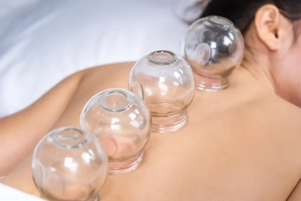 Glass cupping therapy cups placed along a client's upper back
